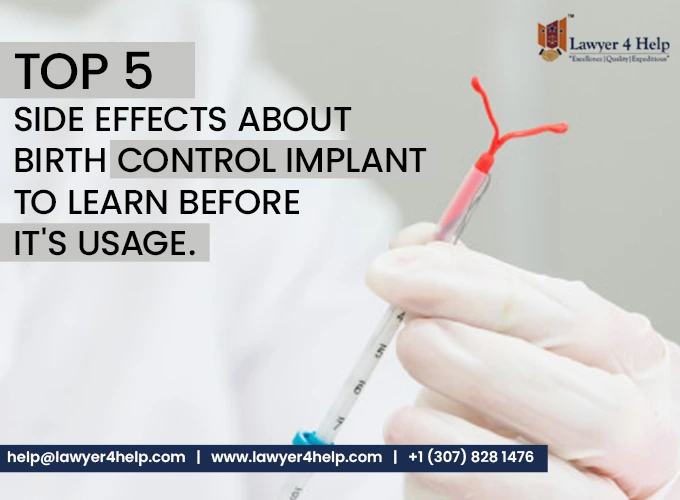 Top 5 side effects about birth control implant to learn before its usage